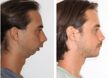 Desconforto funcional na região orofacial