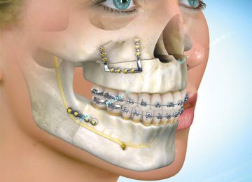 Saúde Bucomaxilofacial: o que você precisa saber